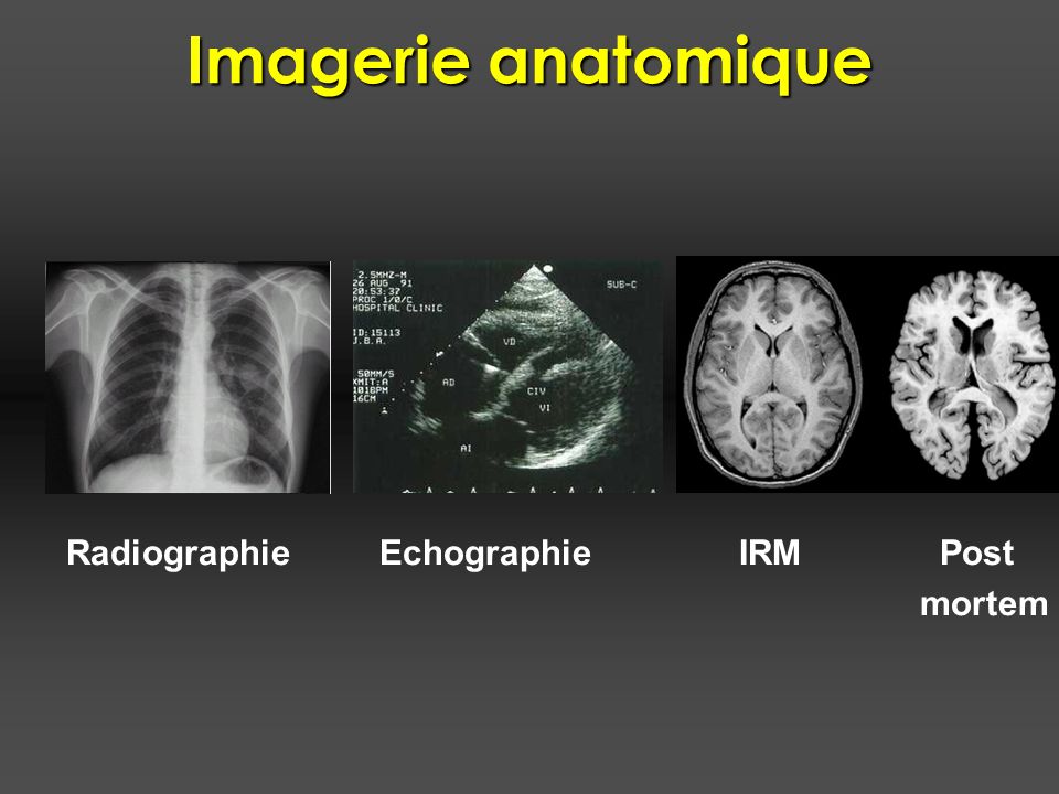 echographie et radiographie